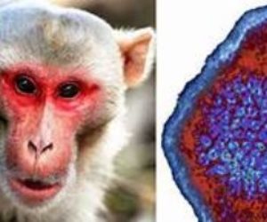المملكة المتحدة تعلن رصد سلالة جديدة من فيروس جدري القرود.. وهذه أعراضه