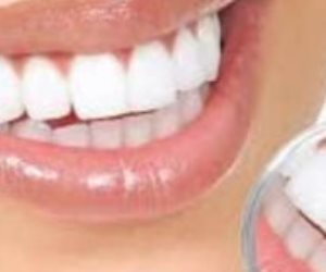 6 طرق تؤثر بها مشكلات الأسنان على صحتك العامة