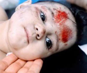 إسرائيل تستهدف غزة بالفسفور الأبيض.. استشهاد 326 طفلا وإصابة 1217 آخرين