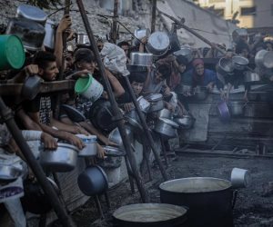 وفاة طفلة عمرها عام ونصف لسوء التغذية فى غزة