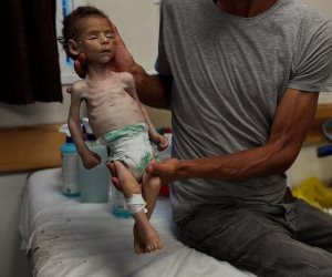 2.1 مليون فلسطينى يواجهون الجوع والعطش ..والأمم المتحدة:الوضع الإنساني في  غزة هو الأسوأ على الإطلاق