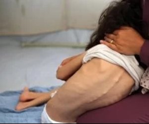 مجمع الشفاء الطبى : انتشار فيروس بين سكان قطاع غزة ولا إمكانية لمعرفة سببه
