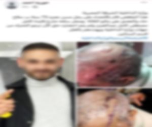 ضبط جزار لتعديه على رجل مسن بالضرب بسلاح أبيض فى القاهرة 