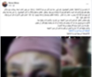 ضبط مرتكب واقعة التعدى على سيدة فى شبرا الخيمة
