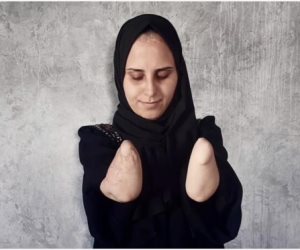 همجية الاحتلال يقضى على أحلام "نبال الهسى" بقذيفة تستهدف خيمتها وتتسبب فى بتر يديها وتحرمها من احتضان ابنتها الرضيعة