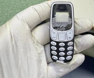 استخراج هاتف محمول من بطن مريض بعد 11 شهرا بمركز الجهاز الهضمي بالمنصورة