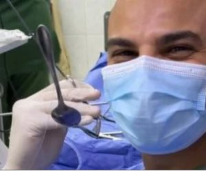 استخراج ملعقة من بطن سيدة مسنة في مستشفى شبين الكوم التعليمي بالمنوفية