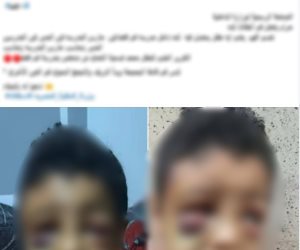 كشف ملابسات واقعة تعرض طفل للضرب وإحداث إصابته داخل إحدى المدارس بقنا