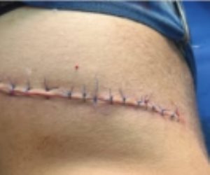 كشف ملابسات واقعة تعدٍ طالب على زميله بسلاح أبيض أمام مدرسة بالمنوفية