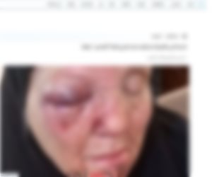 كشف ملابسات قيام أحد الأشخاص بالتعدي على والدته المسنة بالغربية