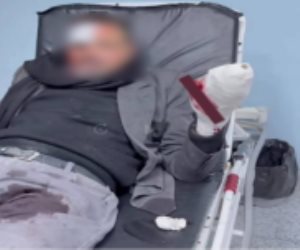 كشف ملابسات قيام شخص بالتعدي على آخر بالضرب وإحداث إصابته بسلاح أبيض بالقاهرة