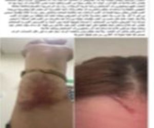 ضبط سيدة وأبنتها تعديا بالضرب على ممرضتين داخل إحدى المستشفيات ببورسعيد  