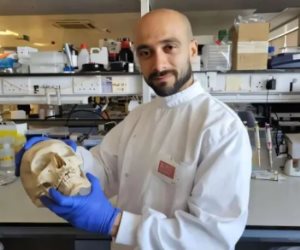 بقيادة باحث مصري.. ابتكار بريطاني يحوّل الصوف إلى مادة واعدة لإصلاح العظام