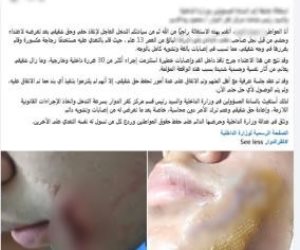 طفل يصيب زميله بقطعة زجاج خلال مشاجرة بالبحيرة