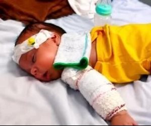 مأساة طفل فلسطيني .. الرضيع محمد الخطيب فقد أمه وبترت قدمه فى غارة إسرائيلية وينتظر فرصة العلاج خارج غزة