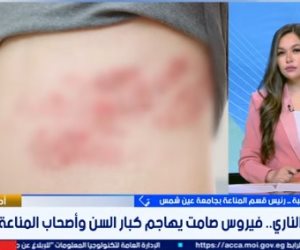 احذر الحزام الناري.. طبيب يوضح الأعراض والفئات الأكثر عرضة