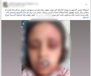ضبط عامل بالشرقية لاعتدائه على زوجة شقيقه بالضرب داخل مسكنها