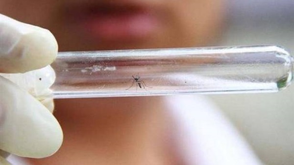 إسبانيا تسجل أول حالة «صغر رأس» مرتبطة بفيروس زيكا