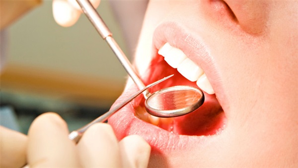 تعرف على 10 عادات خاطئة قد تدمر أسنانك