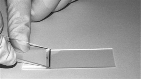 شريحة إلكترونية دقيقة للكشف عن الأمراض من قطرة دم واحدة