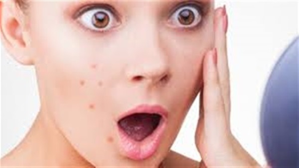 كريم جل الصبار لعلاج حب الشباب بشكل نهائى