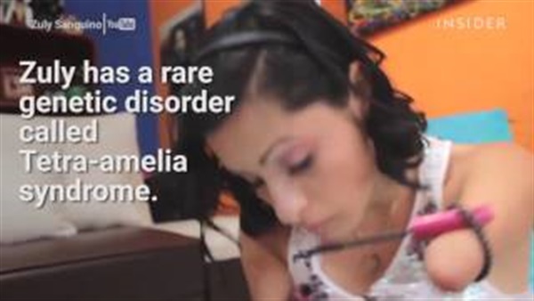 بالفيديو..زولي سانجو: امرأة بدون أطراف تتحدى إعاقتها وتساعد الآخرين