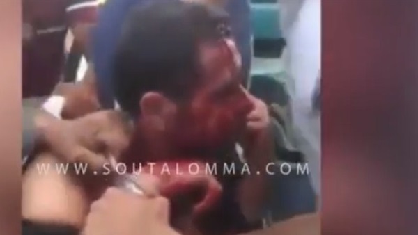 بالفيديو.. التفاصيل الكاملة لسحل مواطن بكفر الشيخ.. أهالى «مطوبس» ينتقمون لشيخ البلد بتعذيب القاتل.. «كامل» يتعدى على المجنى علية لخلافات أسرية.. وأفراد المنطقة يقوموا بالتشهير به قبل تسليمة للشرطة 