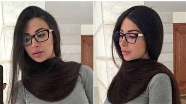 بالصورة.. شقيقة «ميريام فارس» تخضع لعملية تكبير لـ «شفتيها»