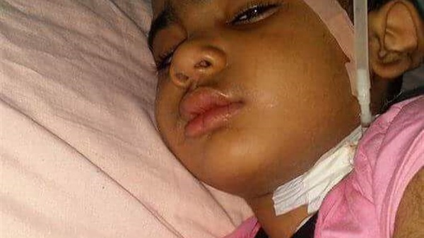 بالصور..الطفل «سيف» فى عمر الزهور يصارع الموت بمستشفى صيدناوى بالزقازيق بعد إصابته بفشل فى وظائف النخاع.. الأم: ابنى يحتاج عملية بـ130 ألف دولار..الأب يدشن حملة لجمع تبرعات.. والصحة توفر 12 ألف دولا