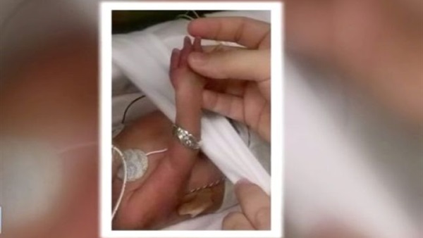 بالصور.. رغم تأكيد الأطباء بعدم حملها.. حدث ما لم يكن في الحسبان