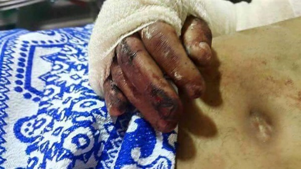 بالفيديو والصور.. المصريون بالخارج «ياقلبي لا تحزن».. «رجل أعمال أردنى» يخطف مواطن ويكسر عظامه.. «كويتي» يدهس أخر بسيارته.. والرجوع علي «نقاله» نهاية المطاف.. والخارجية «ودن من طين وودن من عجين»