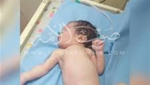 طبيب التخدير فى واقعة فقد طفل عضوه الذكرى يعترف بخطأه