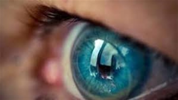 عدسات لاصقة متطورة لسرعة توصيل الدواء للعين بين مرضى الجلوكوما