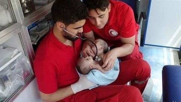 وفاة توأم سيامي سوري بعد إجلائه من منطقة محاصرة