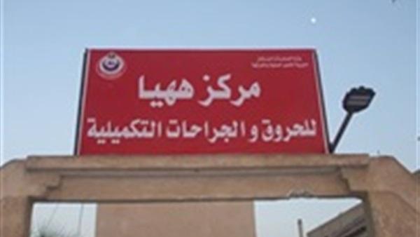 استقبال أول حالة من خارج المحافظة بمركز حروق «ههيا»