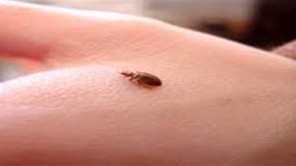 حشرة "بق الفراش" تغزو المدن الفرنسية