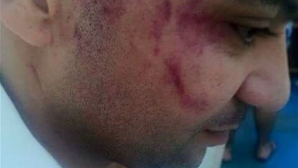 الأردن: «مفيش بلطجة علي المصريين.. والموضوع في خلافات»