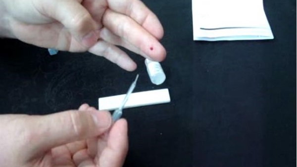 «USB» أحدث أجهزة الكشف عن الإيدز