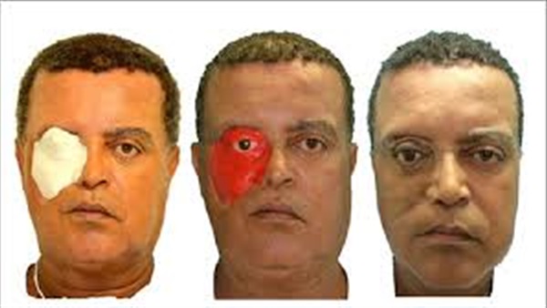 أول شخص في العالم يحصل على وجه مطبوع بتقنية 3D