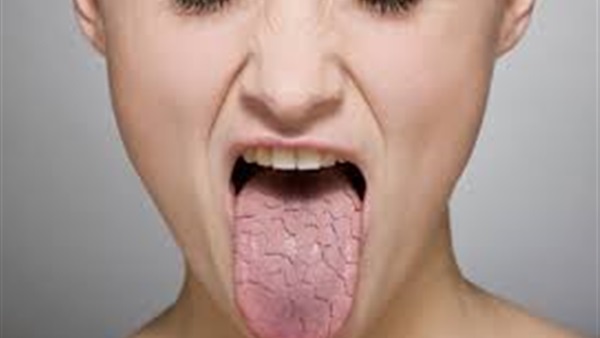 بحة الصوت.. الأسباب والعلاج