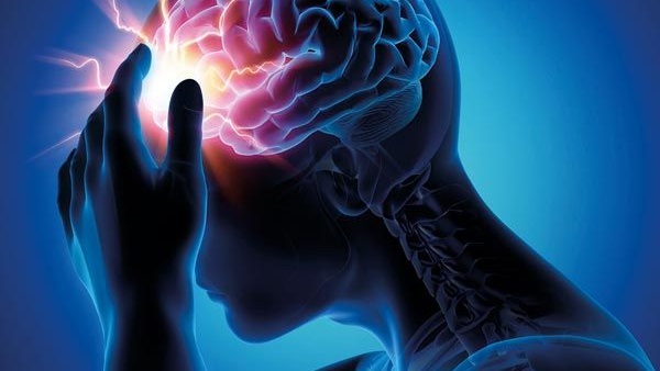 دراسة: النجاة من السكتة الدماغية يؤدي إلى الصرع
