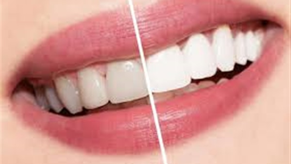 4 أضرار لاستخدام ليزر الأسنان.. تعرف عليها