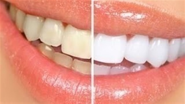 كاميرا رقمية مصغرة ذات طابعة ثلاثية الأبعاد تصلح الأسنان