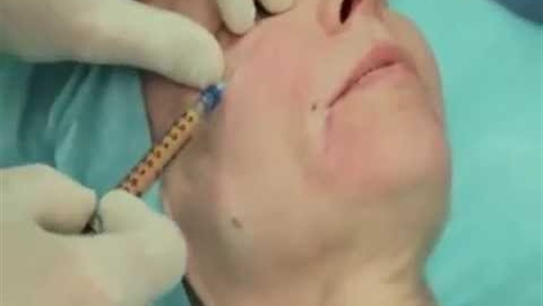 85% من أطباء التجميل يحقنون الوجه بـ«الدهون»
