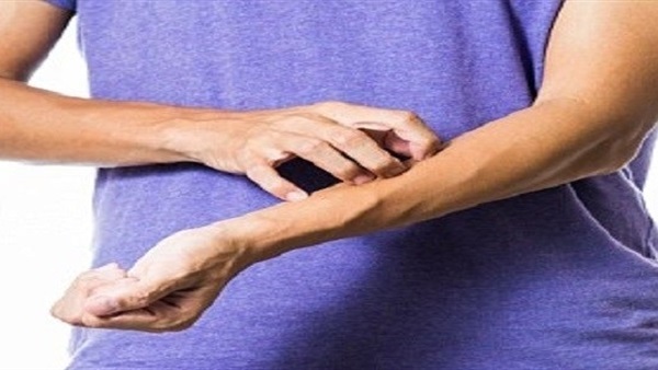 علاجات جديدة للأمراض الجلدية 