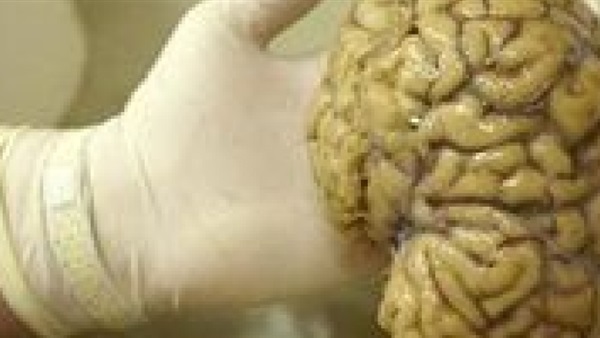 الأوقات الصعبة تلقى بآثارها السلبية على صحة المخ