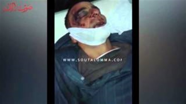 بالفيديو.. آثار تعذيب الشرطة على جثة ضحية كفر الشيخ 